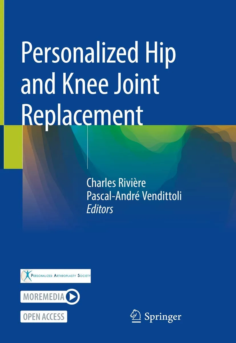 Personalized Hip And Knee Joint Replacement | Hardcover