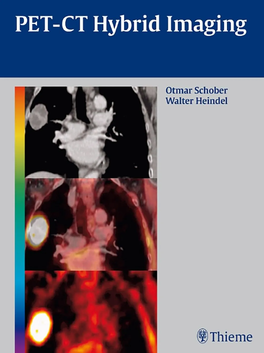 Pet-CT Hybrid Imaging | Hardcover