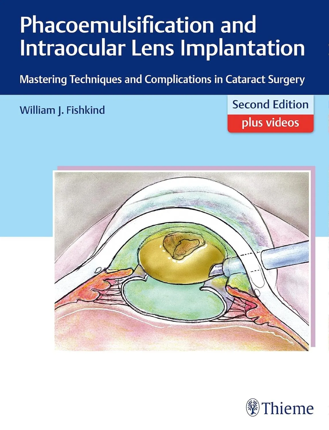 Phacoemulsification and Intraocular Lens Implantation | 2nd Edition | Hardcover