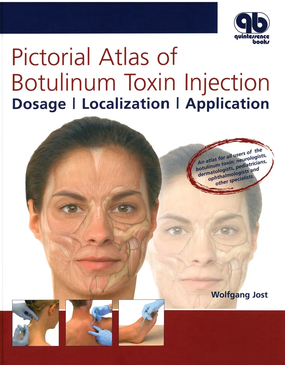 Pictorial Atlas of Botulinum Toxin Injection Dosage | Localization | Application | 2nd Edition | Hardcover