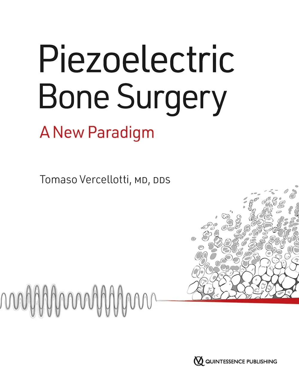 Piezoelectric Bone Surgery A New Paradigm | Hardcover