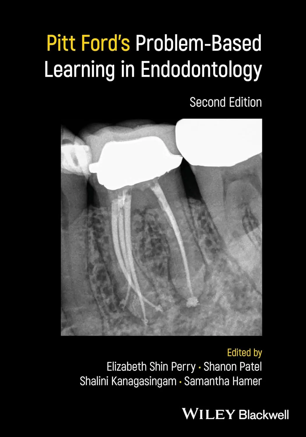 Pitt Fords Problem Based Learning In Endodontology 2nd Editiond | Paperback