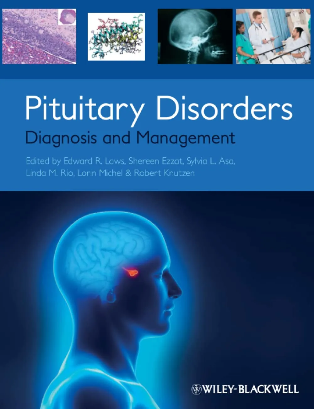 Pituitary Disorders Diagnosis and Management | Paperback