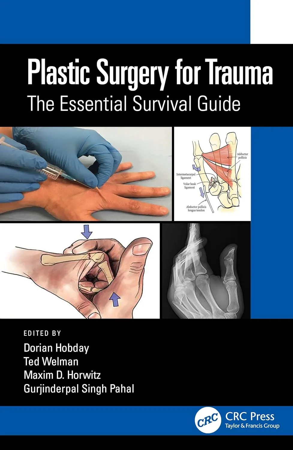 Plastic Surgery For Trauma The Essential Survival Guide | Paperback