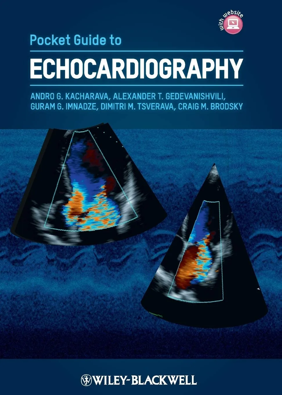 Pocket Guide to Echocardiography | Paperback