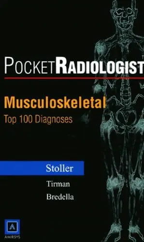 Pocket Radiologist Musculoskeletal Top 100 Diagnosis | Paperback