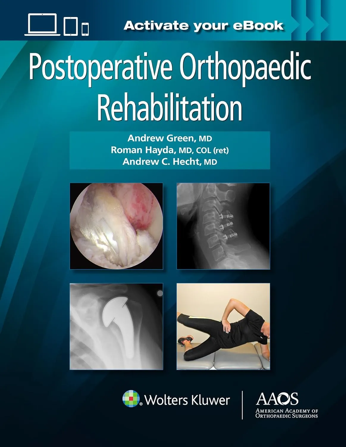 Postoperative Orthopaedic Rehabilitation | Hardcover