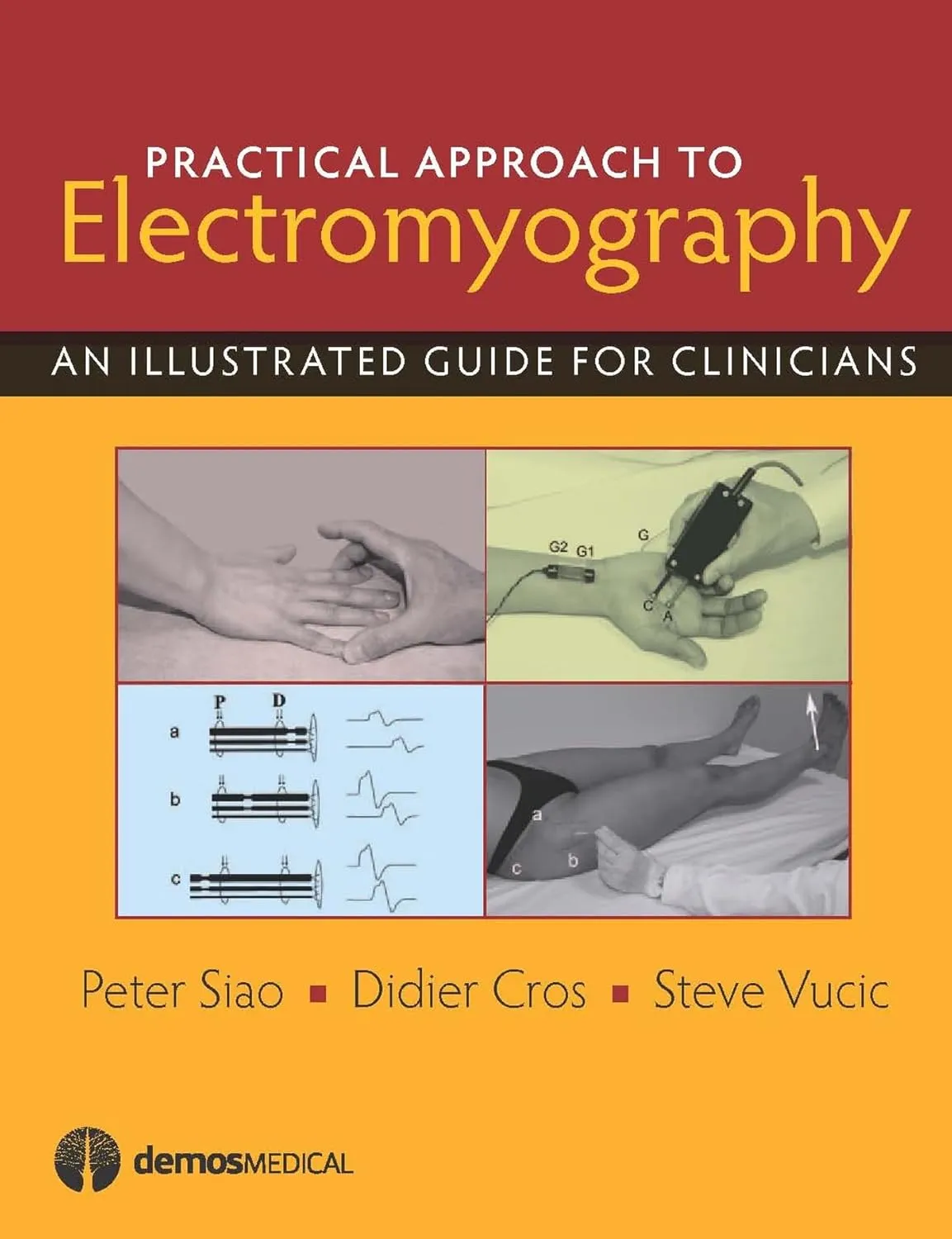 Practical Approach to Electromyography An Illustrated Guide for Clinicians | Hardcover