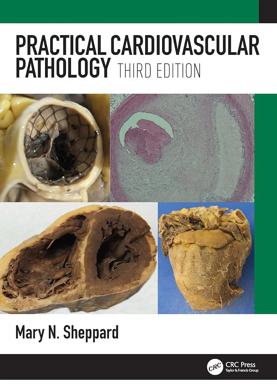 Practical Cardiovascular Pathology Third Edition | Hardcover
