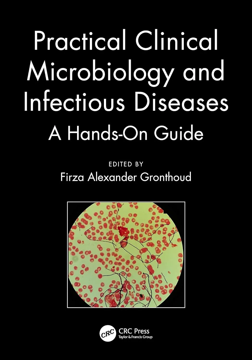 Practical Clinical Microbiology and Infectious Diseases A Hands On Guide | Paperback