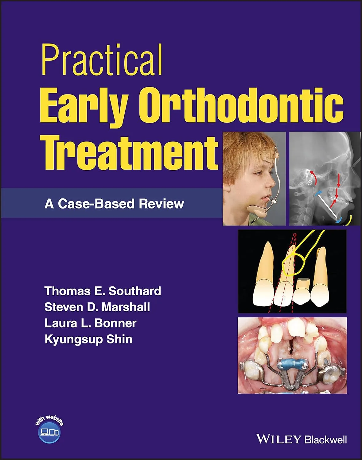 Practical Early Orthodontic Treatment A Case Based Review | Hardcover