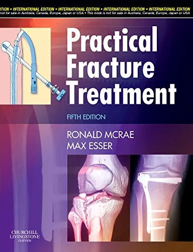 Practical Fracture Treatment | 5th Edition (IE) | Paperback