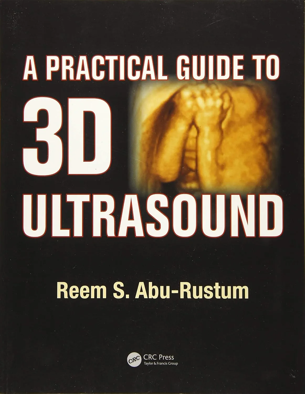 A Practical Guide to 3D Ultrasound | Paperback