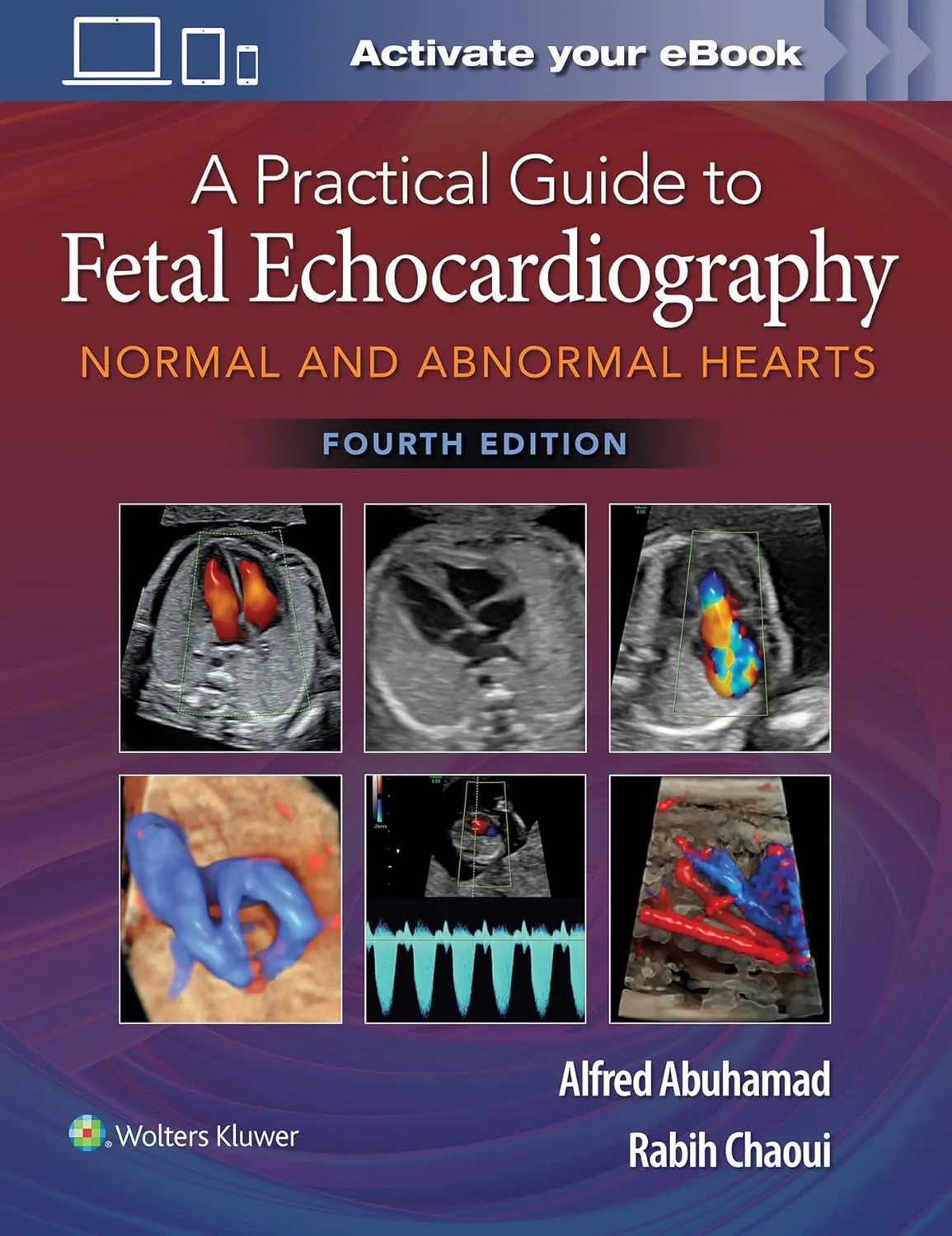 A Practical Guide To Fetal Echocardiography Normal And Abnormal Hearts 4th Edition | Hardcover