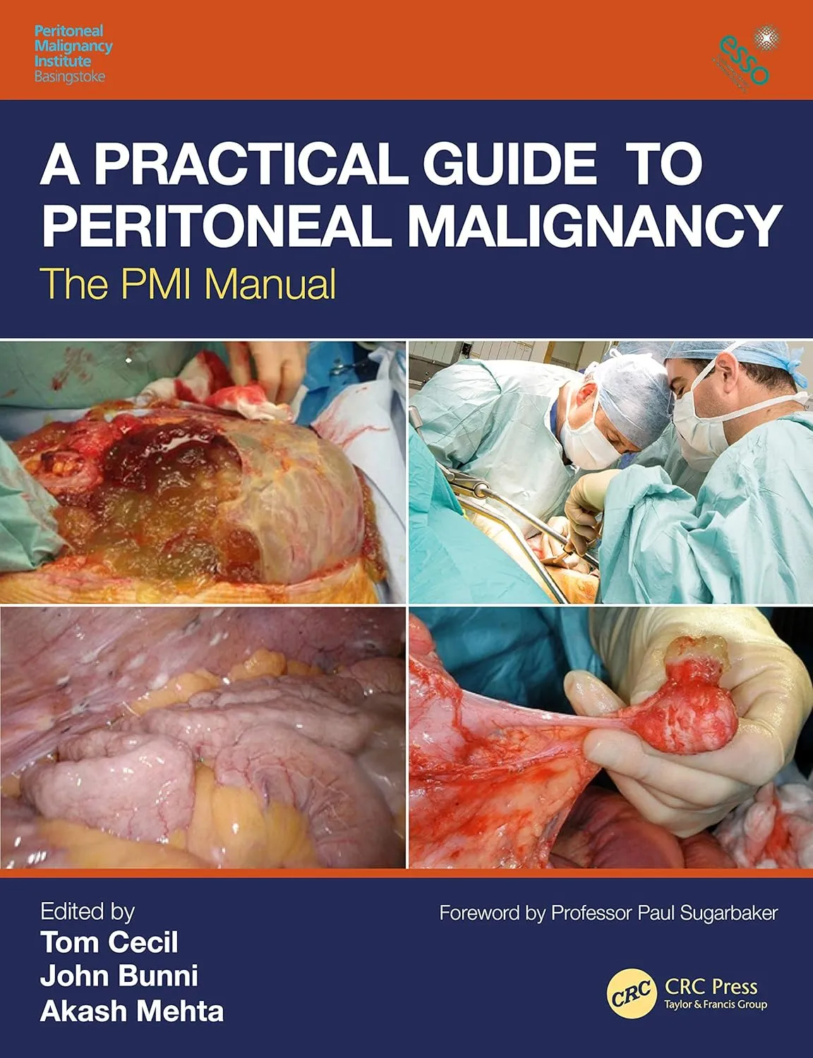 A Practical Guide to Peritoneal Malignancy The PMI Manual | Paperback