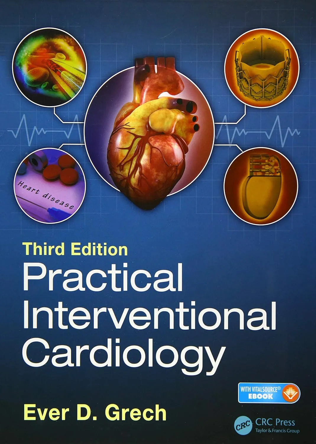 Practical Interventional Cardiology | Third Edition | Hardcover