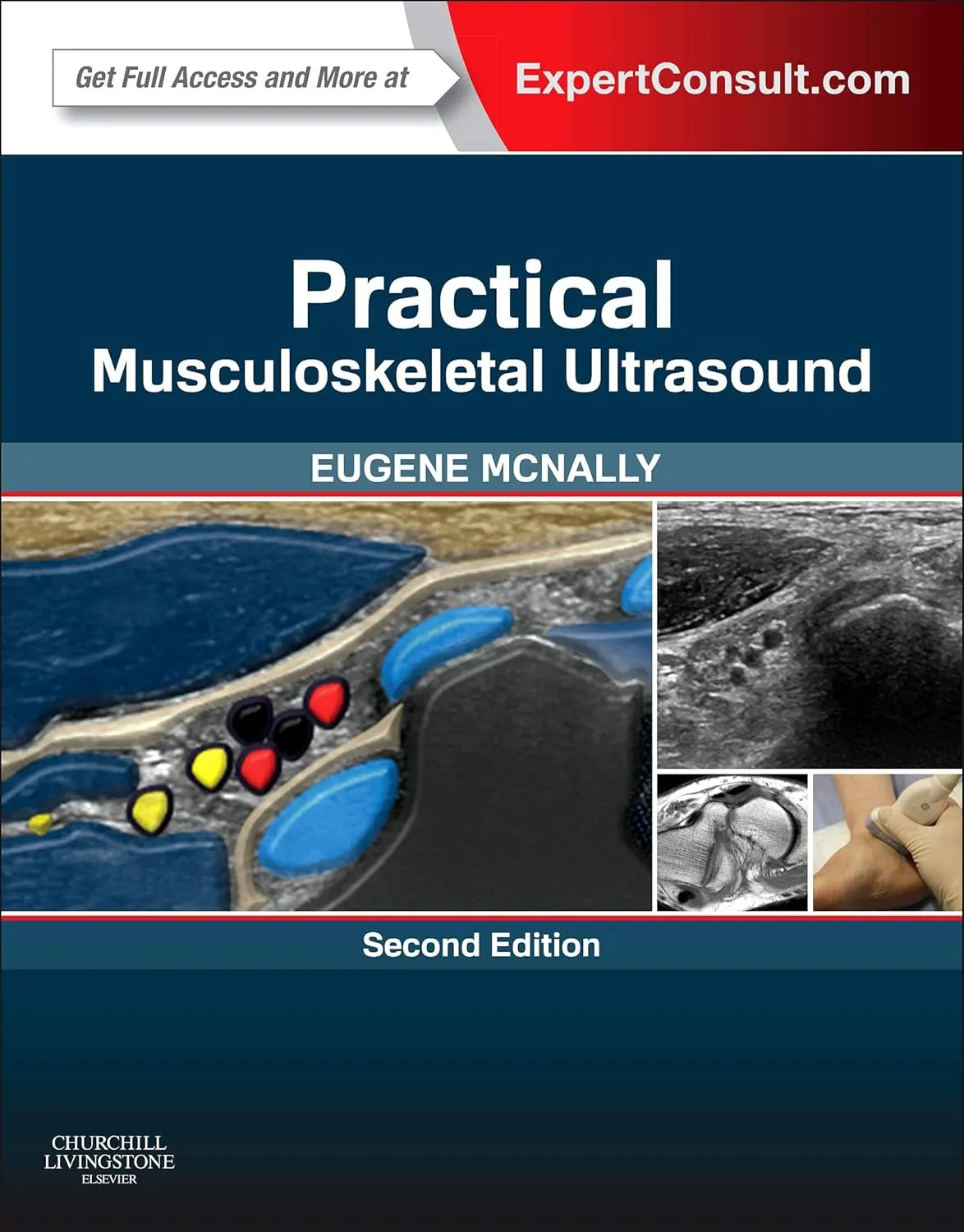 Practical Musculoskeletal Ultrasound | 2nd Edition | Hardcover