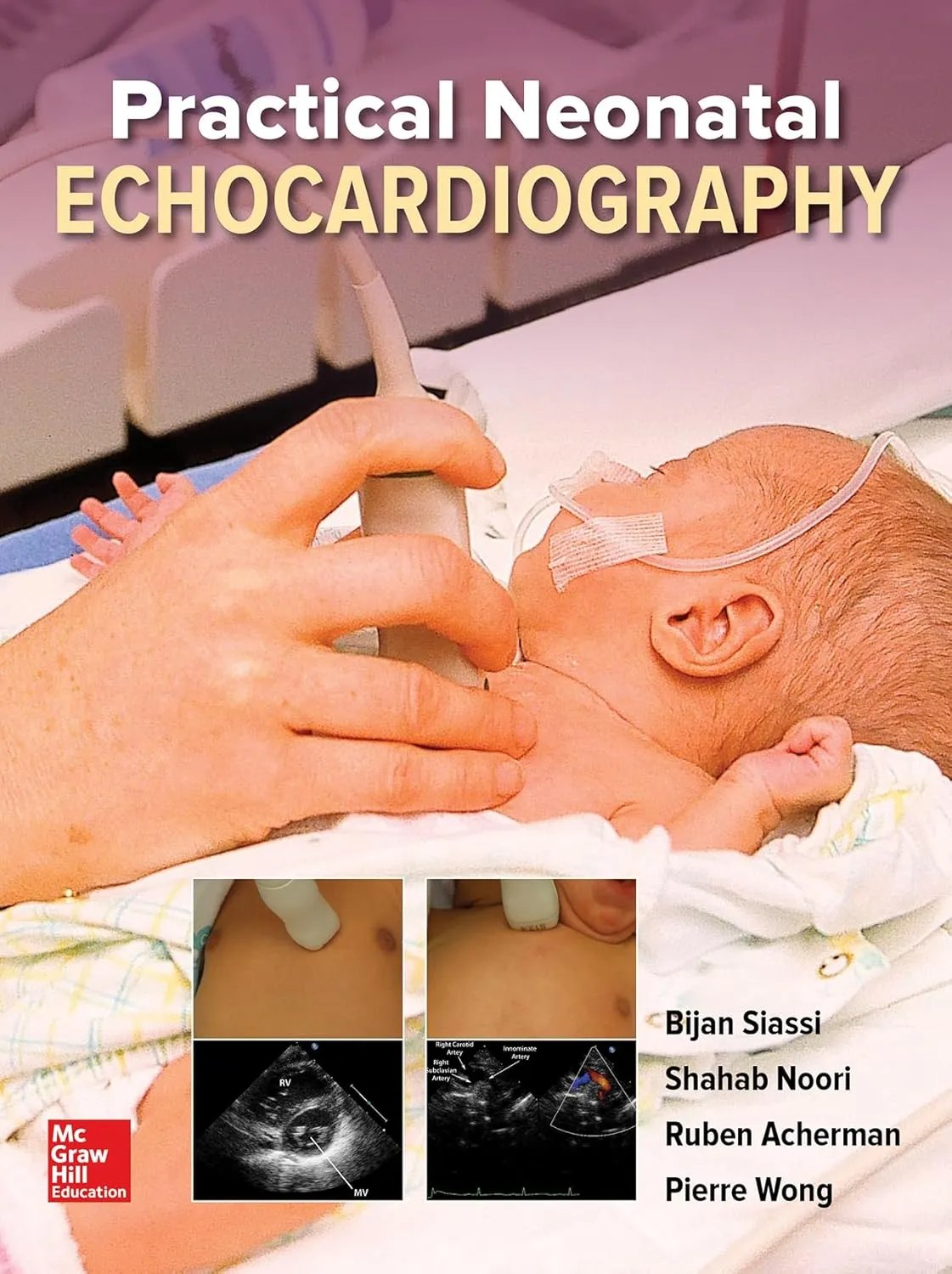 Practical Neonatal Echocardiography | Hardcover