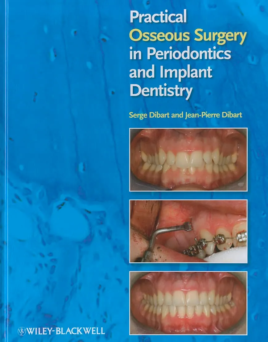 Practical Osseous Surgery in Periodontics and Implant Dentistry | Hardcover