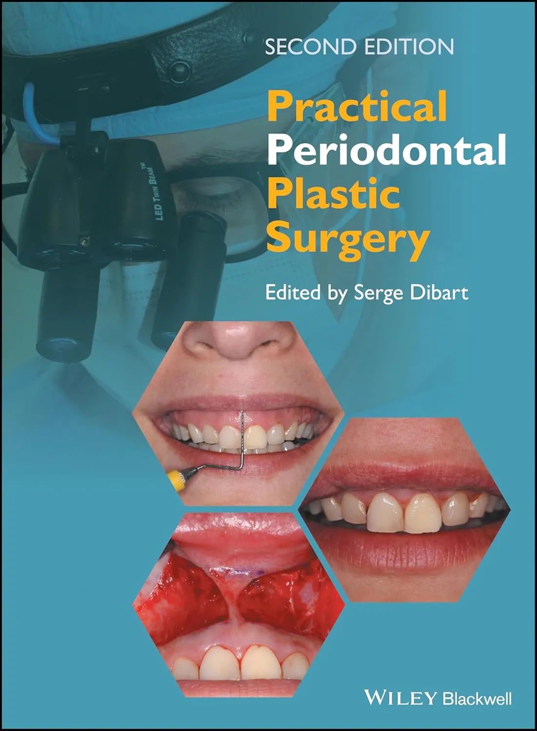 Practical Periodontal Plastic Surgery | 2nd Edition | Hardcover