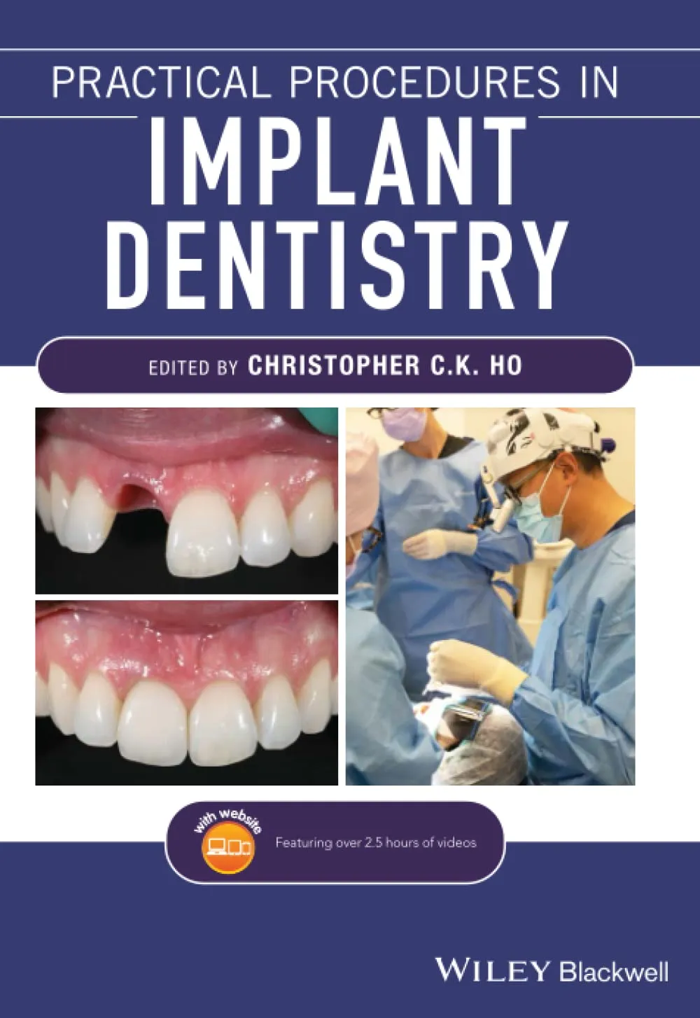 Practical Procedures In Implant Dentistry | Paperback