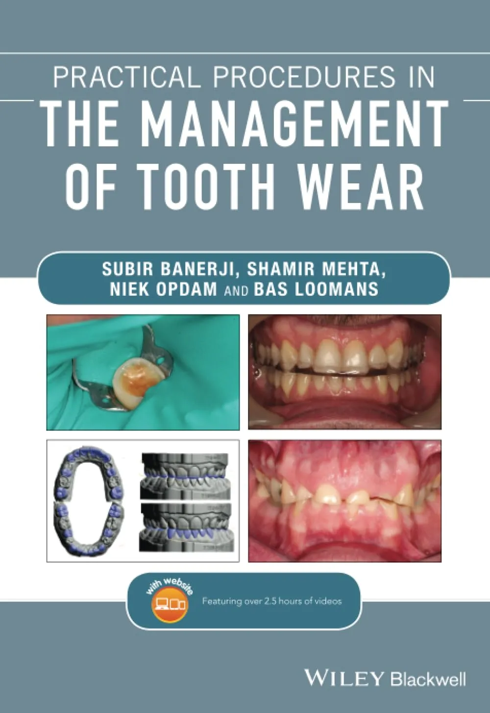 Practical Procedures In The Management Of Tooth Wear | Paperback