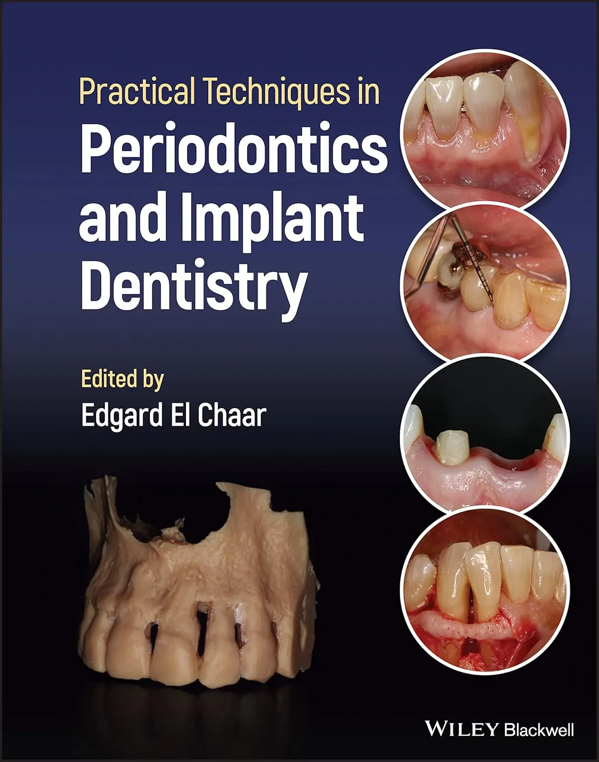 Practical Techniques In Periodontics And Implant Dentistry | Hardcover