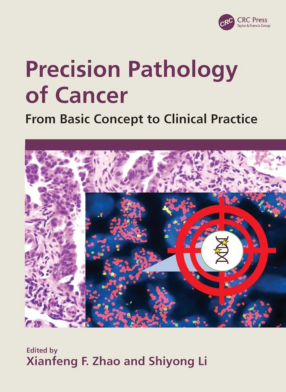 Precision Pathology Of Cancer From Basic Concept To Clinical Practice | Hardcover