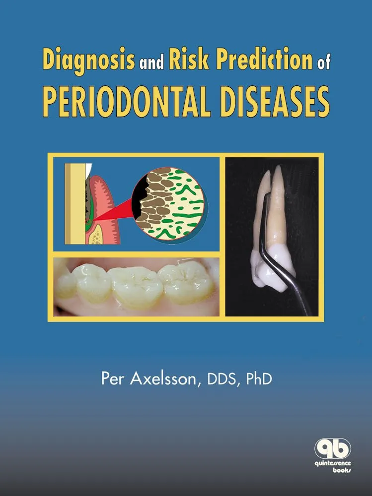 Preventive Dentistry Volume 3 Diagnosis and Risk Prediction of Periodontal Diseases | Hardcover