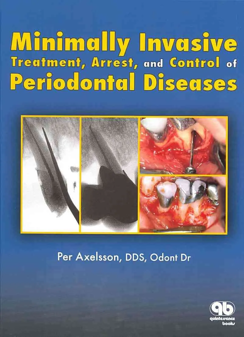 Preventive Dentistry Volume 5 Minimally Invasive Treatment | Arrest | and Control of Periodontal Diseases | Hardcover