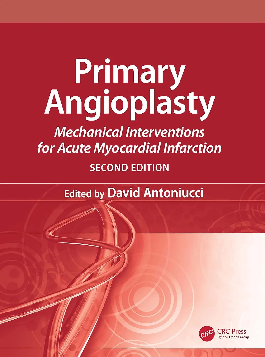 Primary Angioplasty Mechanical Interventions for Acute Myocardial Infarction | 2nd Edition | With DVD | Hardcover