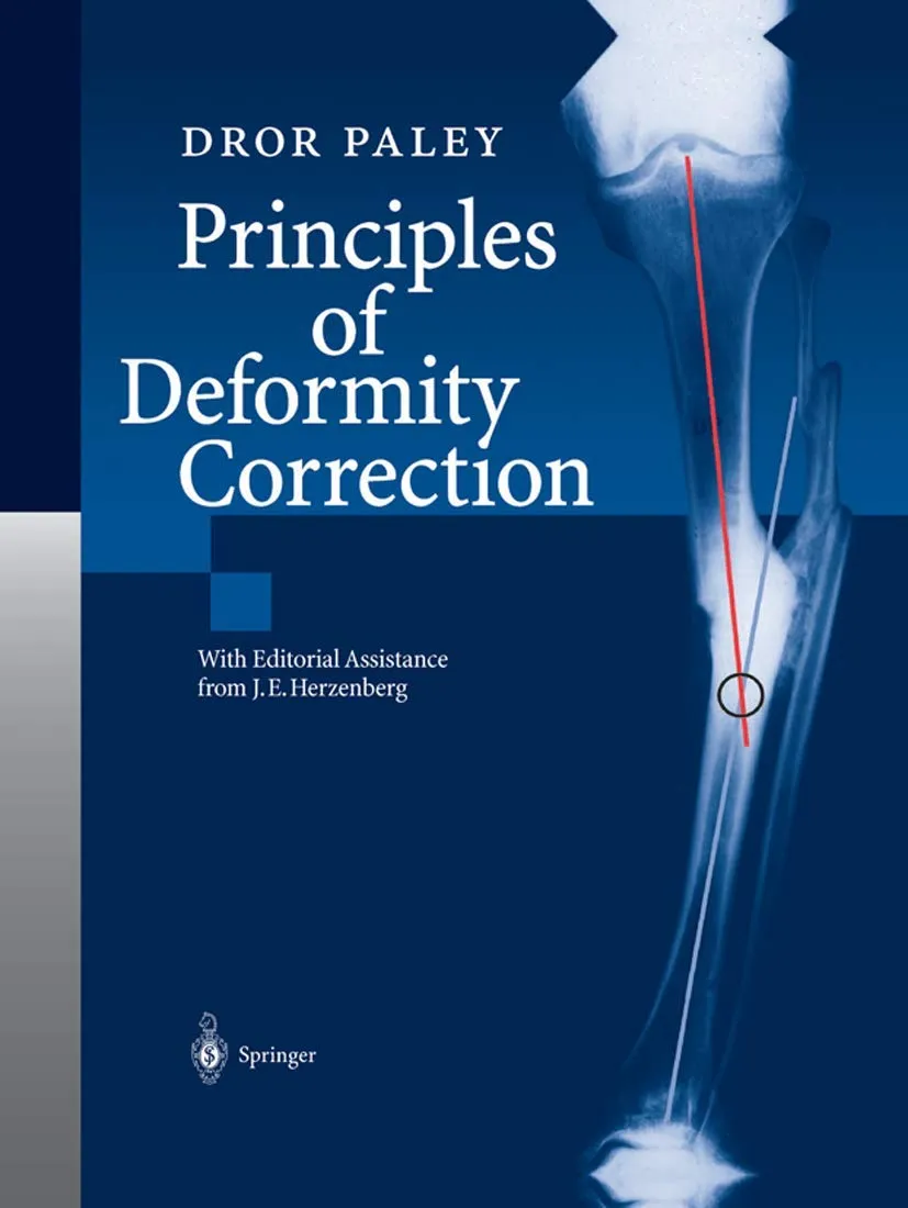 Principles Of Deformity Correction | Paperback