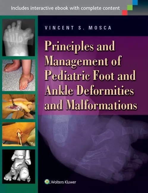 Principles and Management of Pediatric Foot and Ankle Deformities and Malformations | Hardcover