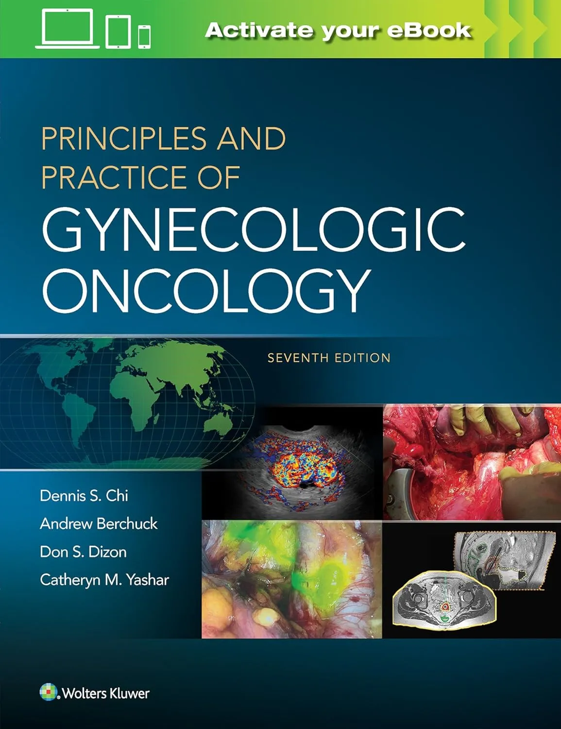 Principles and Practice of Gynecologic Oncology | 7th Edition | Hardcover