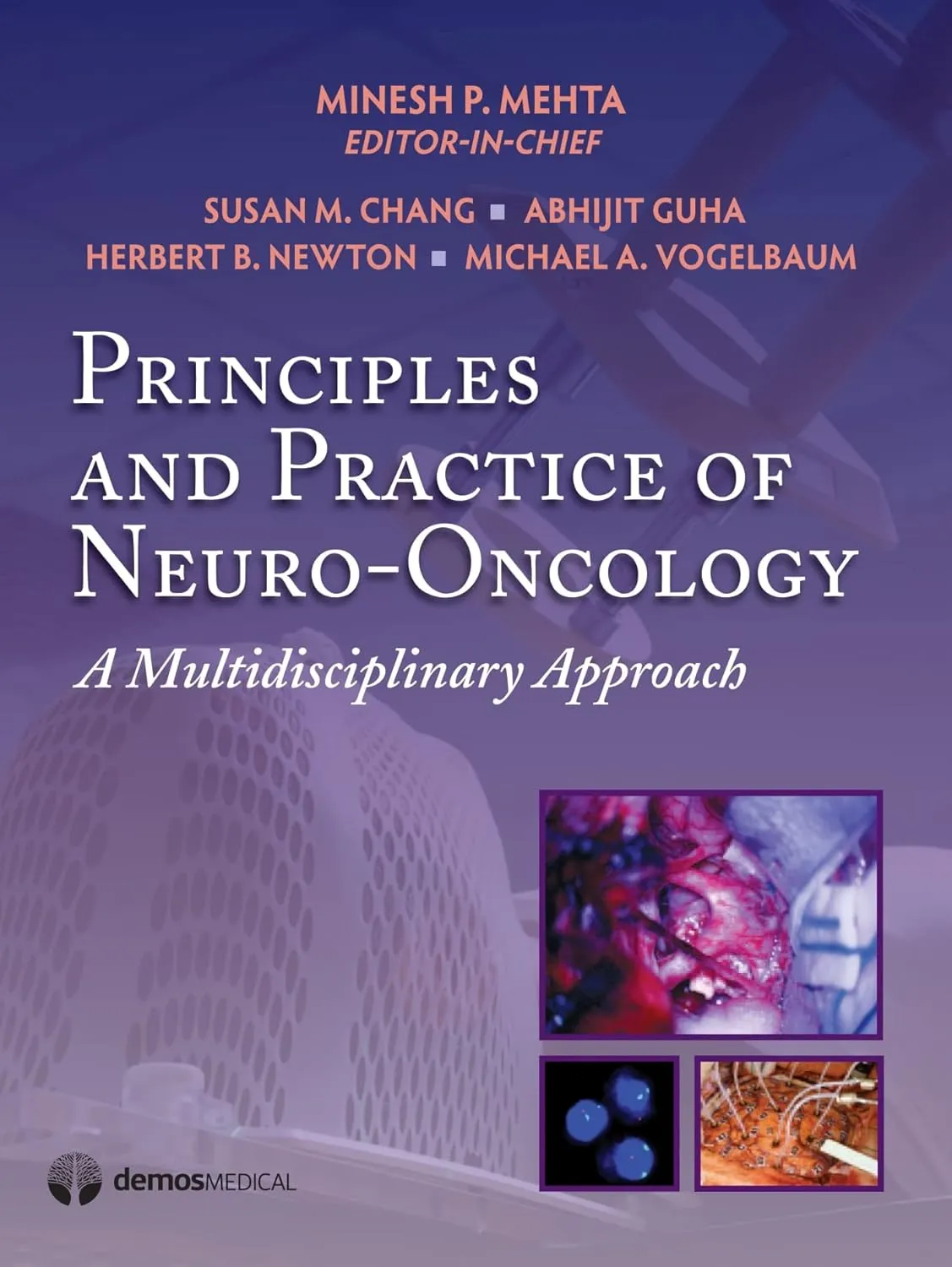 Principles and Practice of Neuro-Oncology A Multidisciplinary Approach | Hardcover