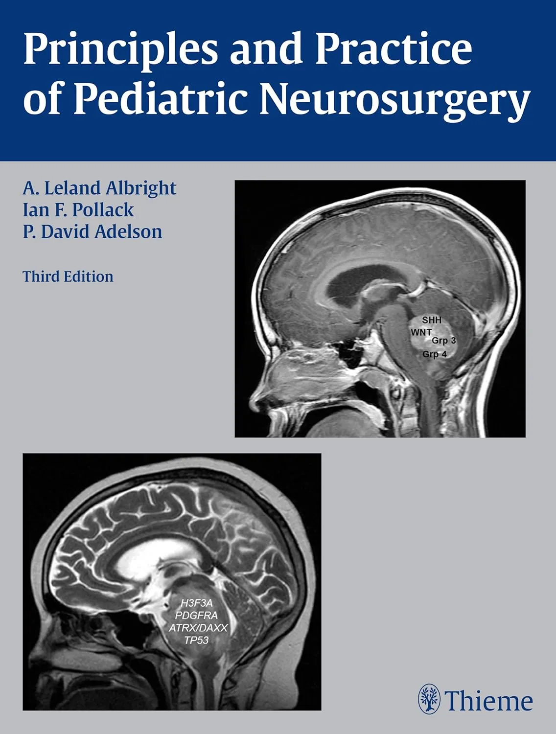 Principles and Practice of Pediatric Neurosurgery | Third Edition | Hardcover