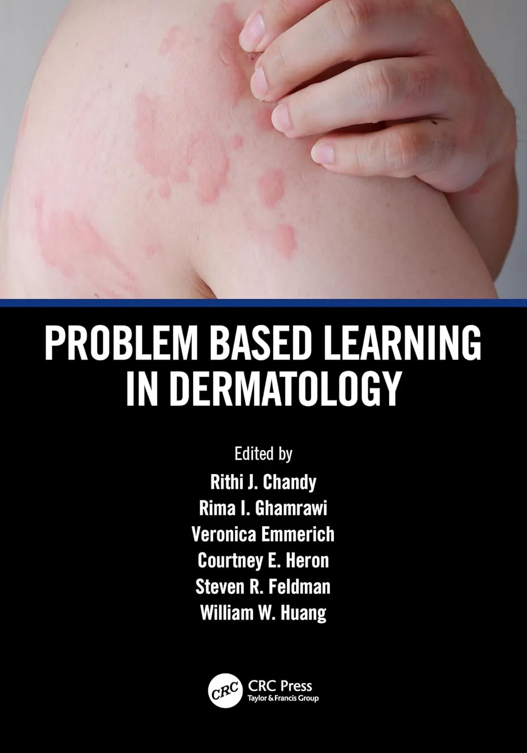 Problem Based Learning In Dermatology | Paperback