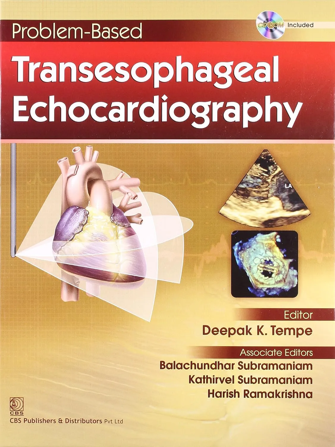 Problem-based Transesophageal Echocardiography with CD | Hardcover