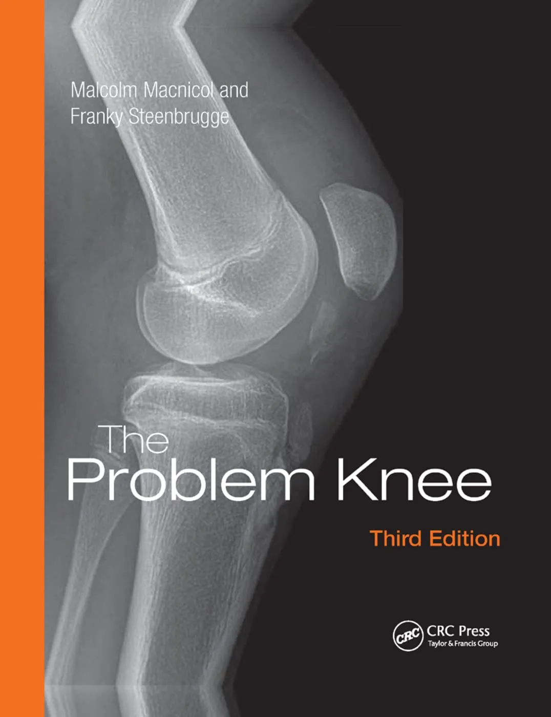 The Problem Knee | Third Edition | Paperback