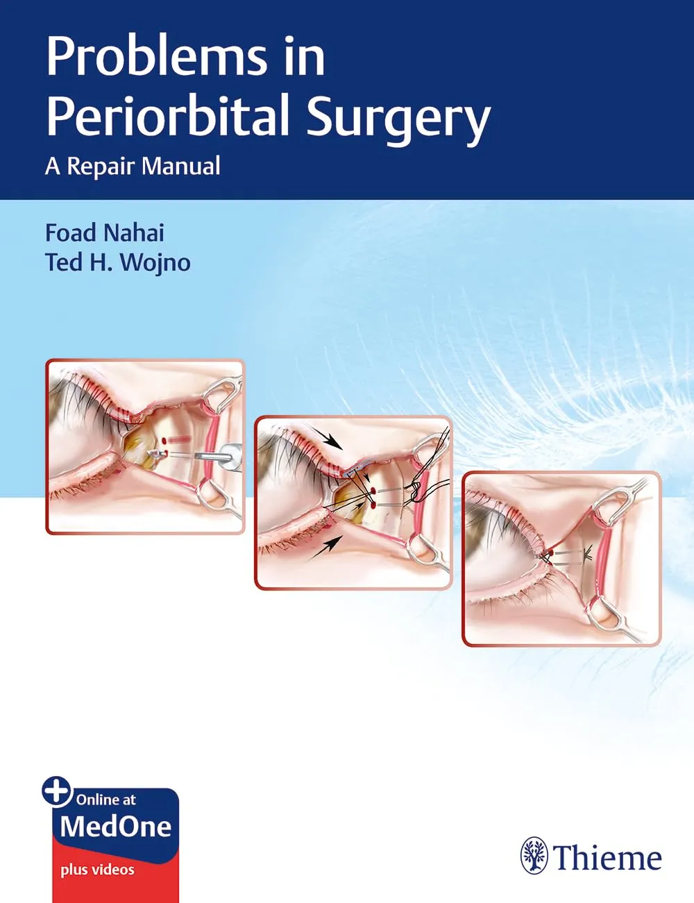Problems in Periorbital Surgery A Repair Manual | Hardcover
