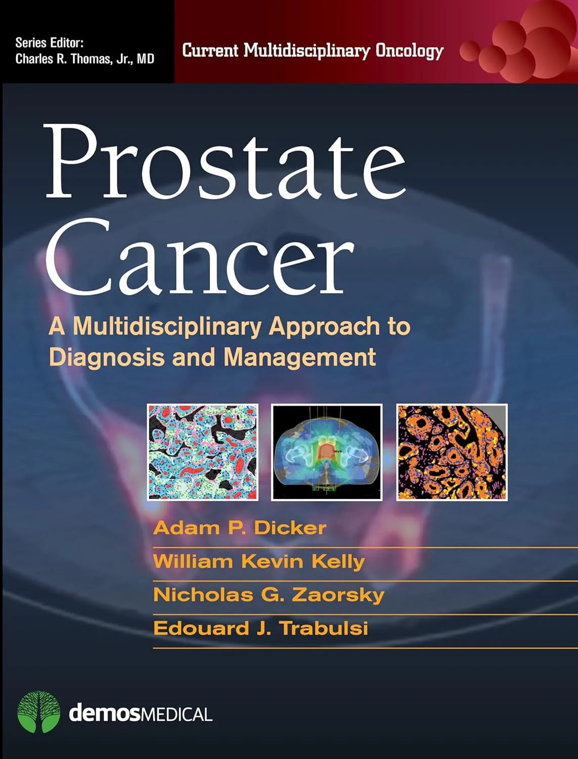 Prostate Cancer | Hardcover