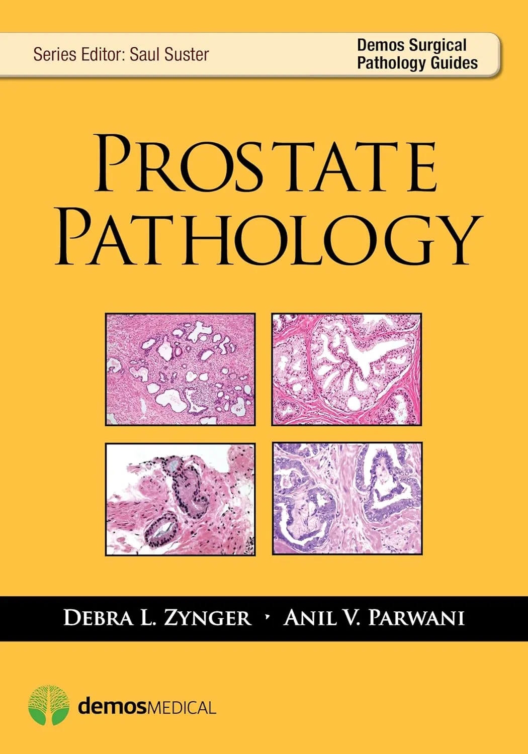 Prostate Pathology | Paperback