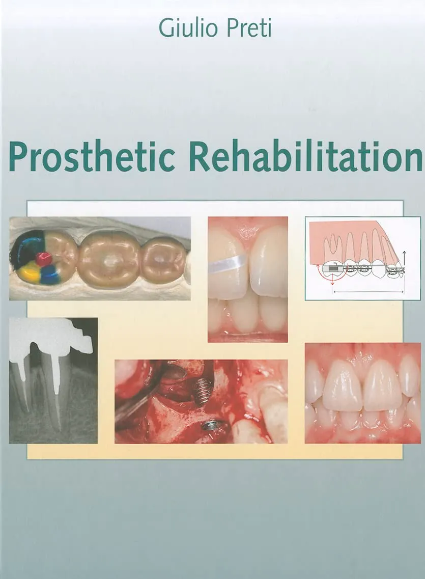Prosthetic Rehabilitation | Hardcover