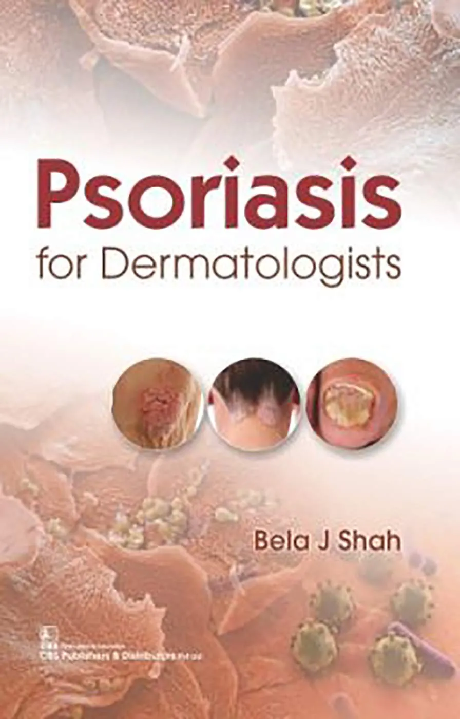 Psoriasis for Dermatologists | Hardcover