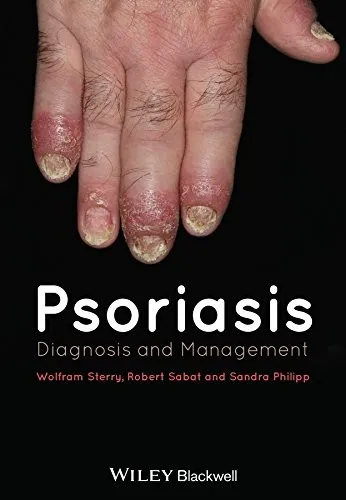 Psoriasis Diagnosis and Management | Hardcover