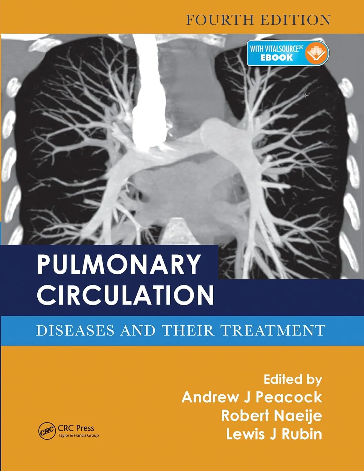 Pulmonary Circulation Diseases And Their Treatment 4th Edition | Paperback