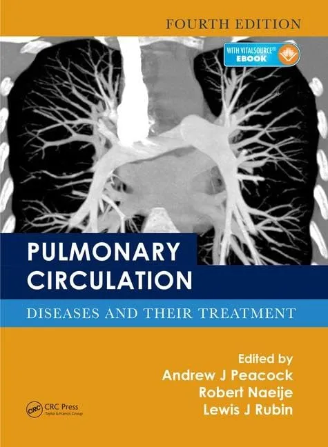 Pulmonary Circulation Diseases and Their Treatment | Hardcover | 4th Edition | Hardcover