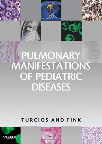 Pulmonary Manifestations of Pediatric Diseases | Hardcover