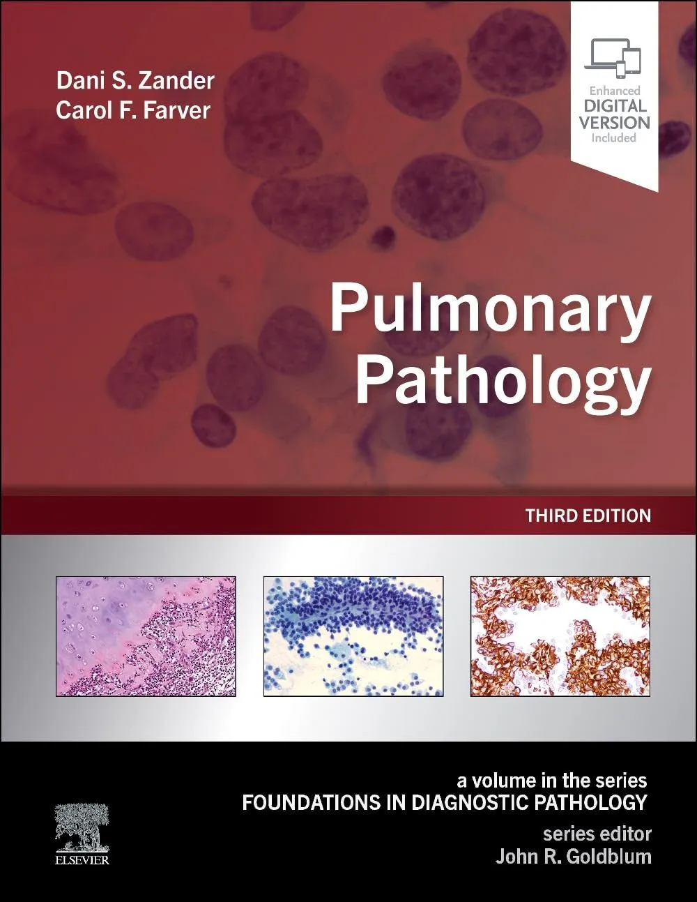 Pulmonary Pathology With Access Code Third Editiond | Hardcover