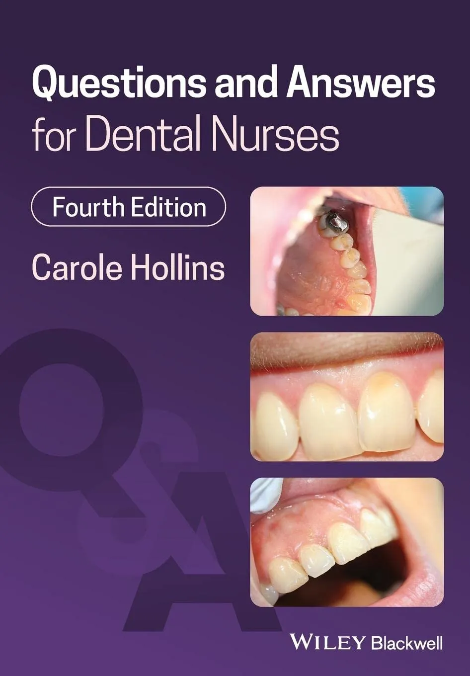 Questions And Answers For Dental Nurses 4th Edition | Paperback